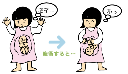 逆子